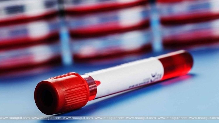 ఏపీ కరోనా అప్డేట్